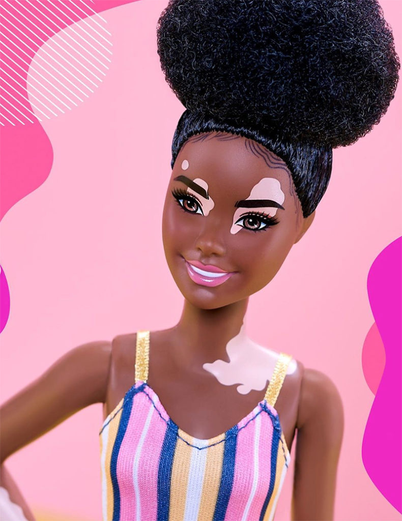 Barbie lanza muñecas con vitiligo.